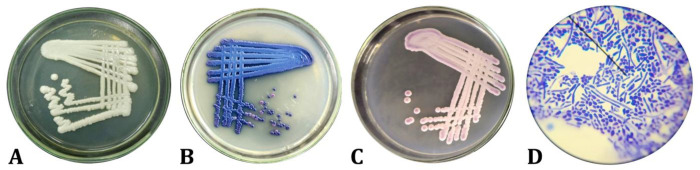 Molecular detection and genetic analysis of <i>Candida</i> species isolated from bovine clinical mastitis in India.