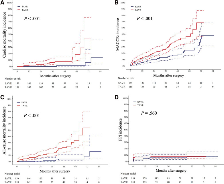 Midterm Clinical Outcomes after Isolated Surgical and Transcatheter Aortic Valve Replacement in Low-Risk Patients with Aortic Stenosis.