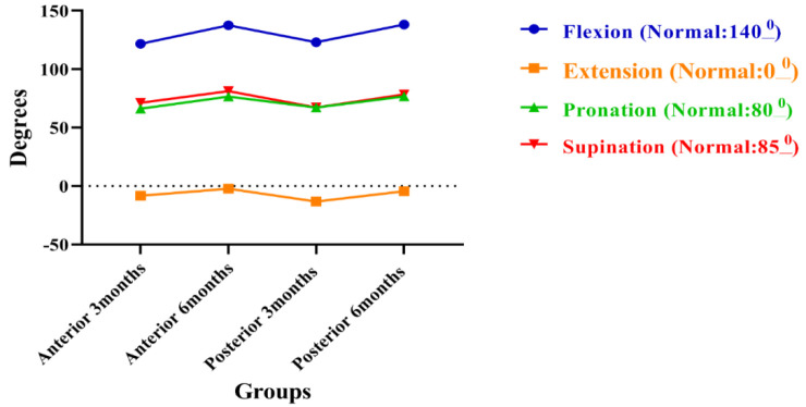 Anterior Versus Posterior Surgical Approaches to Pediatric Supracondylar Humerus Fracture.