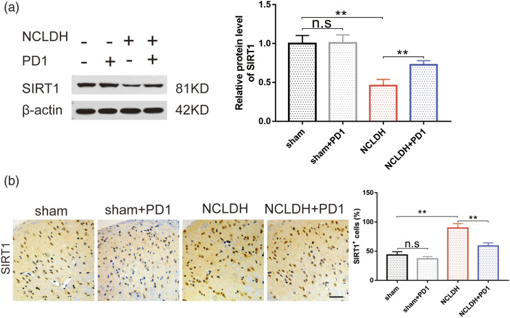 Protectin D1 ameliorates non-compressive lumbar disc herniation through SIRT1-mediated CGRP signaling.