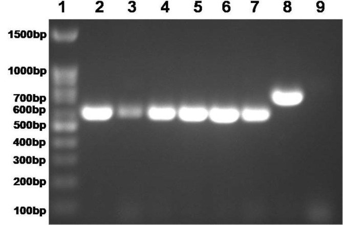 Molecular detection and genetic analysis of <i>Candida</i> species isolated from bovine clinical mastitis in India.