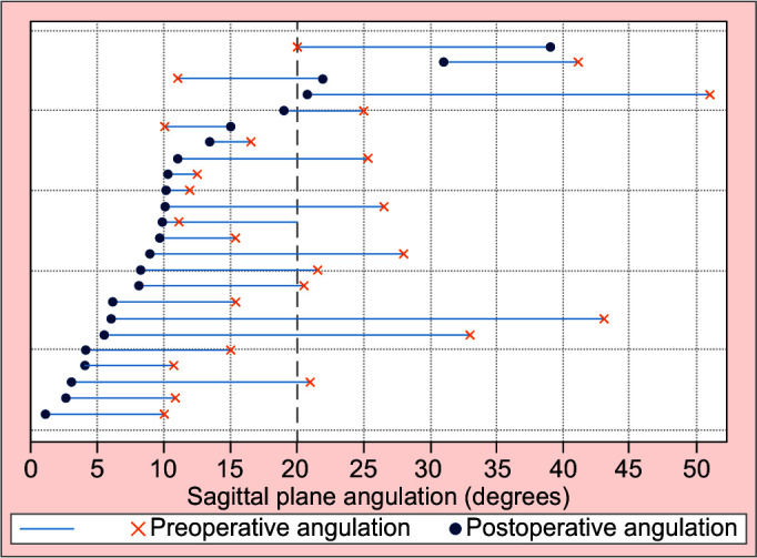 Computer Hexapod-assisted Orthopaedic Surgery for the Correction of Multiplanar Deformities throughout the Lower Limb.