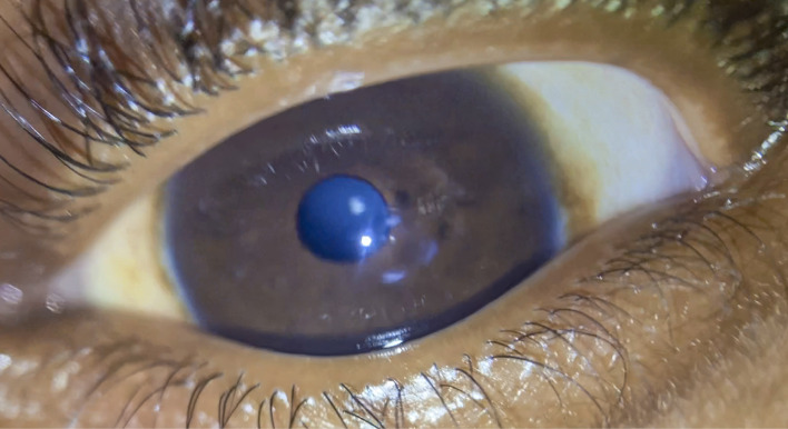 Common conditions affecting the ocular surface.
