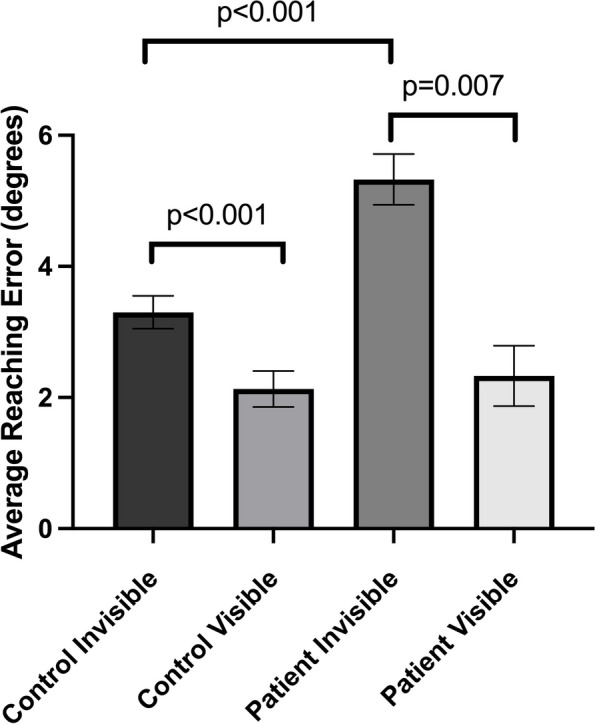 Virtual reality assessment of reaching accuracy in patients with recent cerebellar stroke.