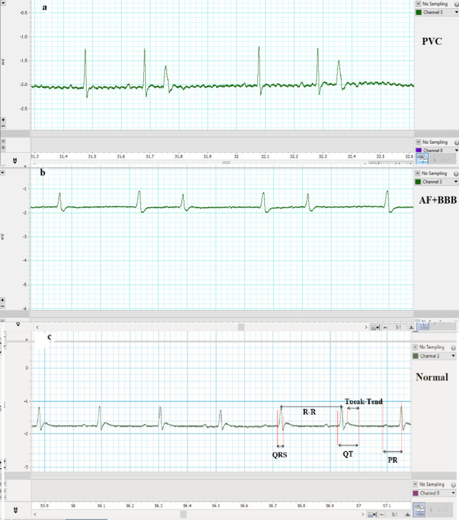 The effects of advanced age on electrocardiographic parameters, lipid profile and redox balance in male rats: role of long-term cinnamon consumption.