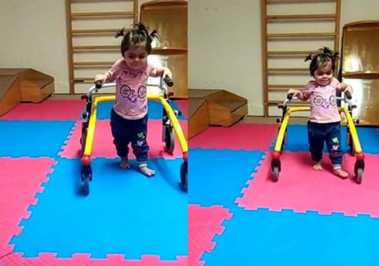Occupational Therapy in Kleefstra Syndrome.