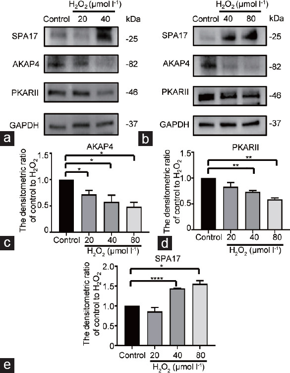 Decreased AKAP4/PKA signaling pathway in high DFI sperm affects sperm capacitation.
