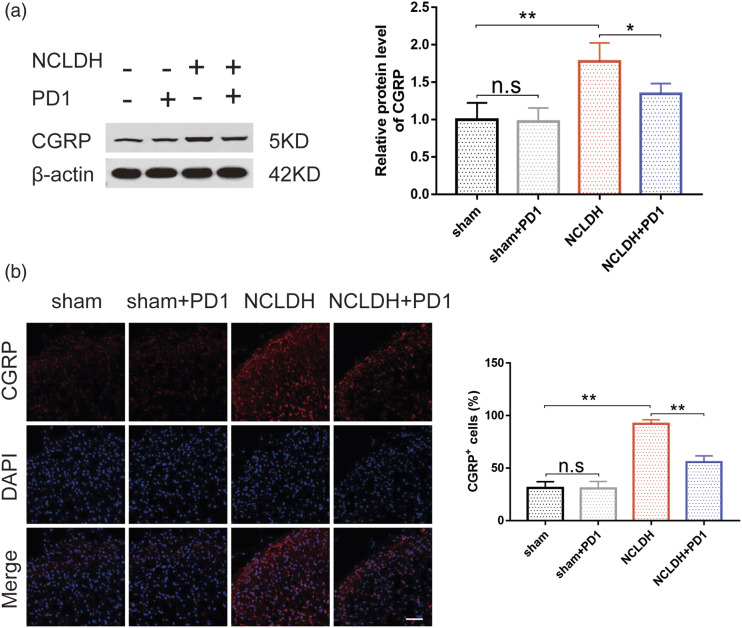 Protectin D1 ameliorates non-compressive lumbar disc herniation through SIRT1-mediated CGRP signaling.