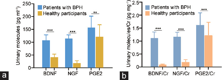 The effect of bladder function on the efficacy of transurethral prostatectomy in patients with benign prostatic hyperplasia: a retrospective, single-center study.