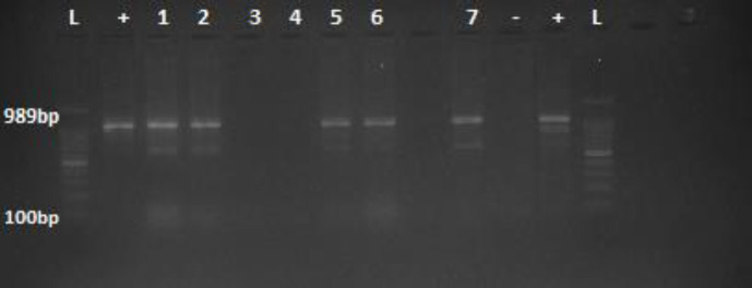 Isolation, serological and molecular methods in screening of <i>Burkholderia mallei</i> in East Azerbaijan province, Iran.
