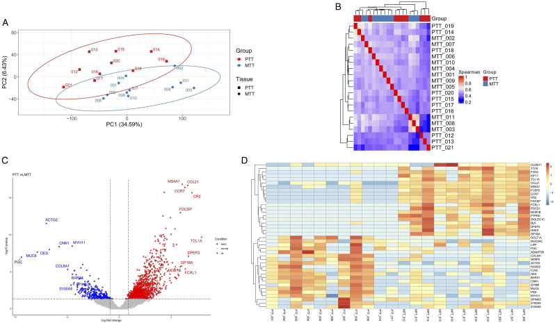 CCL21 and CLDN11 Are Key Driving Factors of Lymph Node Metastasis in Gastric Cancer.