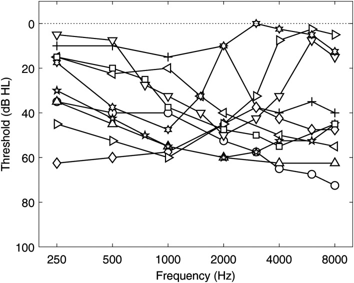 Externalization of Speech When Listening With Hearing Aids.