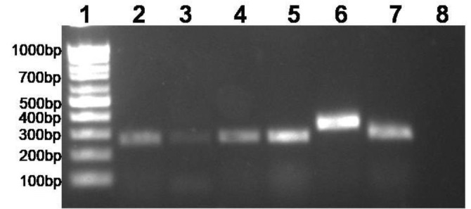 Molecular detection and genetic analysis of <i>Candida</i> species isolated from bovine clinical mastitis in India.