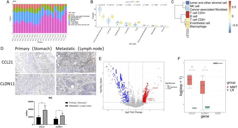 CCL21 and CLDN11 Are Key Driving Factors of Lymph Node Metastasis in Gastric Cancer.