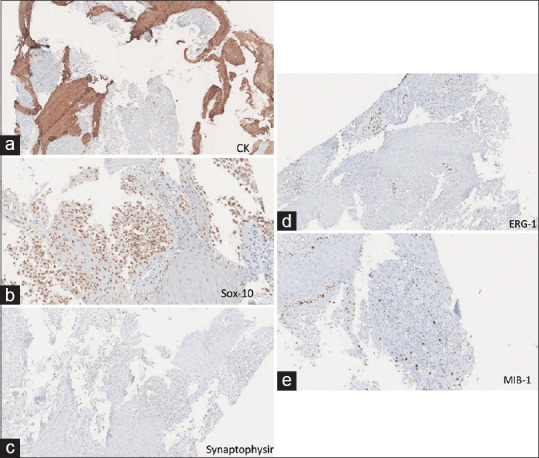 摘要图片