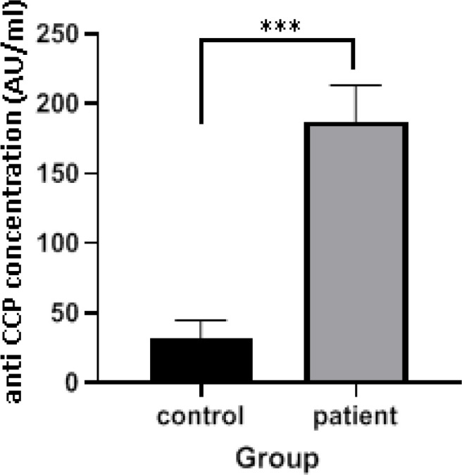 Plasma TNF-α Elevation in Biologic Naive Rheumatoid Arthritis Patients Belonging to a Population with New Mutations in TLR4 and CYP51A1 genes without Association with Disease-Related Antibodies Levels.