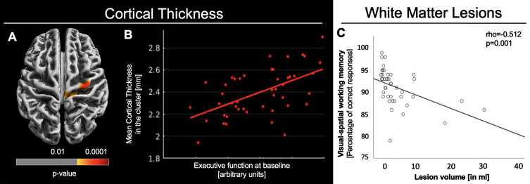 Working Memory Training Responsiveness in Parkinson's Disease Is Not Determined by Cortical Thickness or White Matter Lesions.