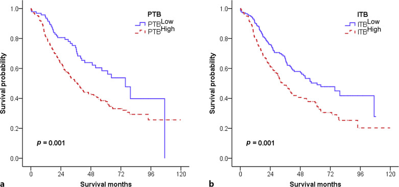 Prognostic Significance of Intratumoral and Peritumoral Budding in Distal Extrahepatic Bile Duct Carcinoma.
