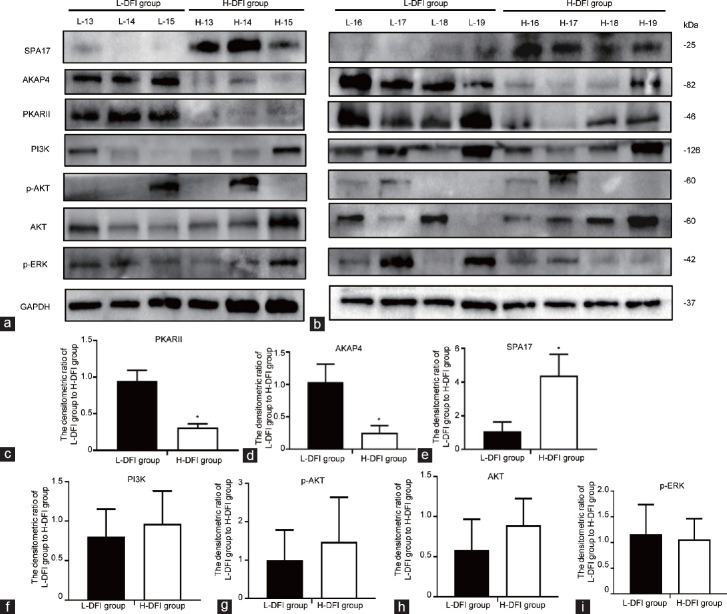 Decreased AKAP4/PKA signaling pathway in high DFI sperm affects sperm capacitation.