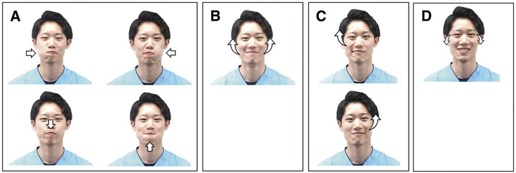 Effects of Smile Training on Gait Disturbance in Parkinson's Disease Patient with Neuropsychiatric Symptoms: A Single Case Design.