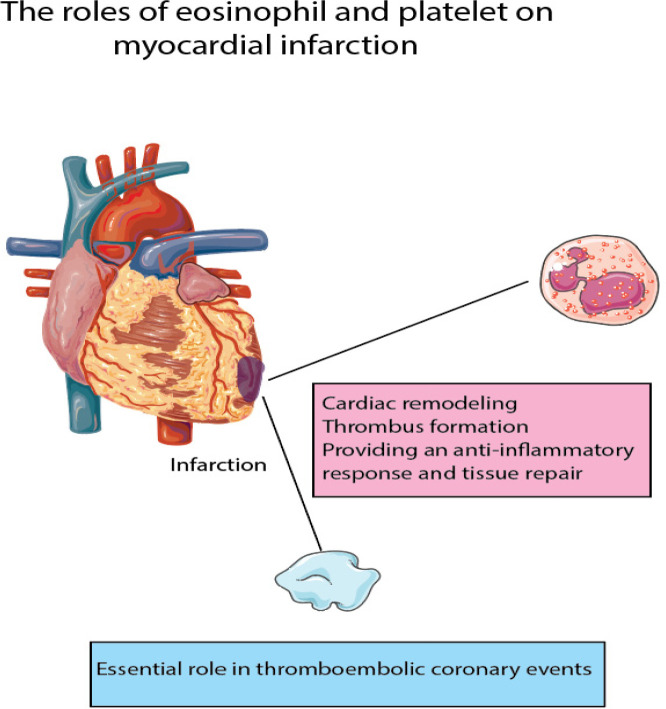 Eosinophil percentage and platelet counts: Association with in-hospital mortality in ST-segment elevated myocardial infarction.
