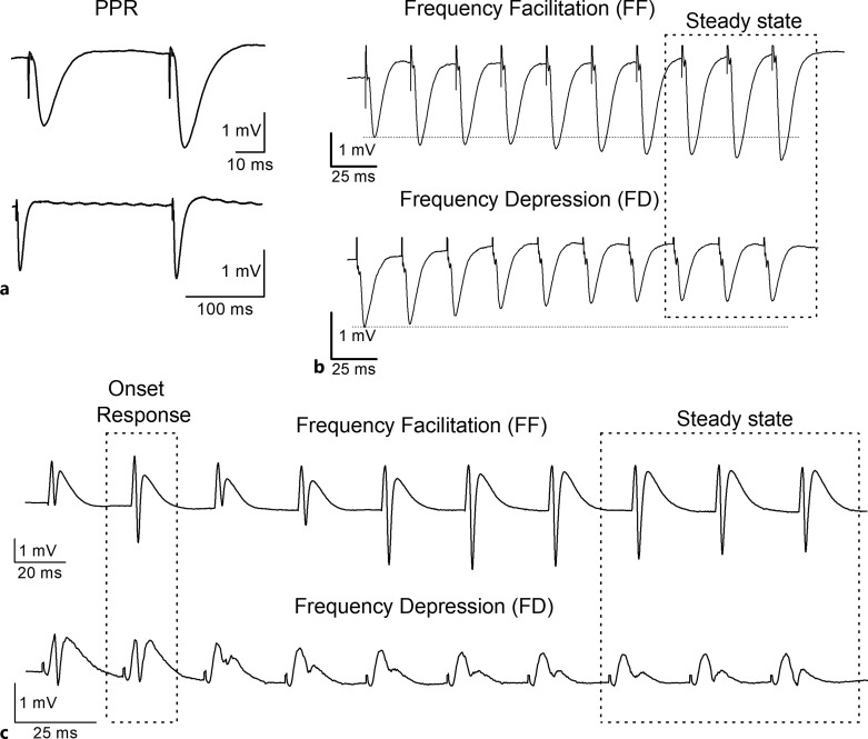 Septotemporal Variation of Information Processing in the Hippocampus of Fmr1 KO Rat.