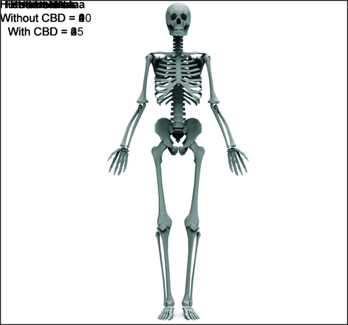 Critical Bone Defect Affecting the Outcome of Management in Anatomical Type IV Chronic Osteomyelitis.
