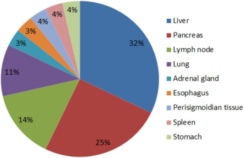 The role of fine-needle aspiration biopsy in the diagnosis of malignant tumors.
