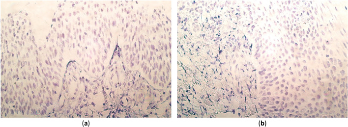 The presence and distribution of various genes in postnatal CLP-affected palatine tissue.