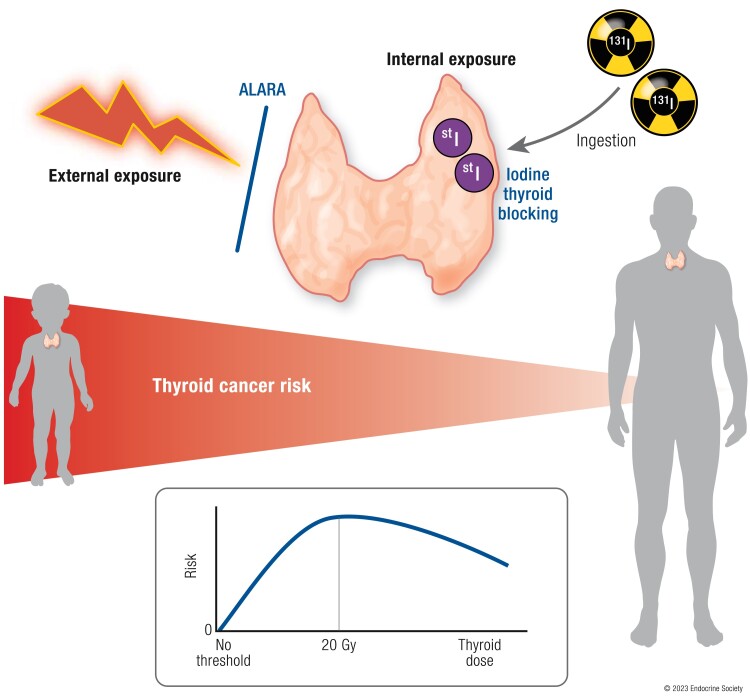 Radiation-Related Thyroid Cancer.