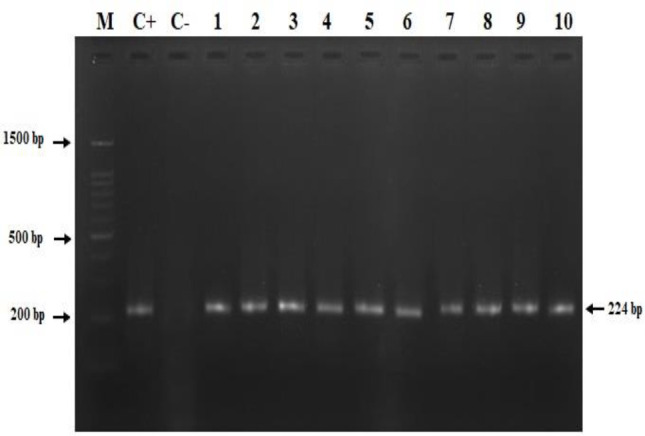 Detection of <i>Brucella</i> infection in raw milk of livestock in Famenin, West part of Iran.