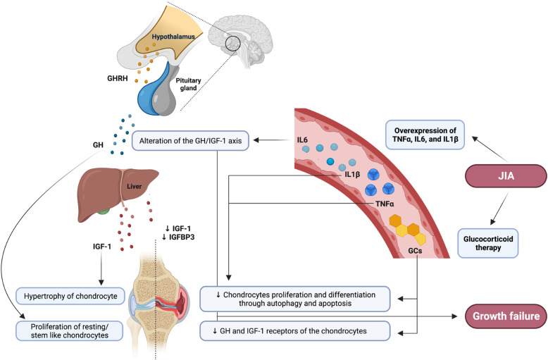 GH therapy in children with juvenile idiopathic arthritis: a four-decade review.