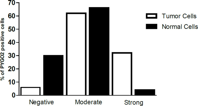 Histopathological Evaluation of PYGO2 Expression in Esophageal Squamous Cell Carcinoma.