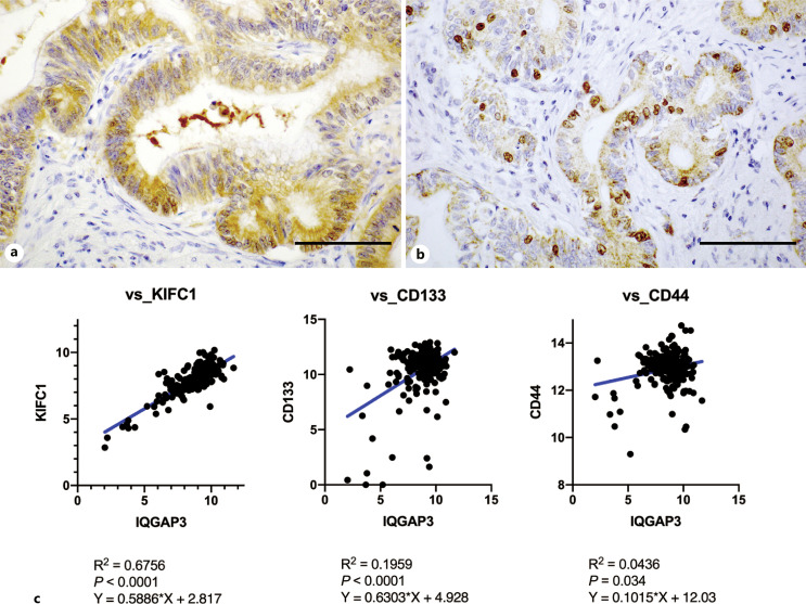 IQ Motif Containing GTPase-Activating Protein 3 Is Associated with Cancer Stemness and Survival in Pancreatic Ductal Adenocarcinoma.