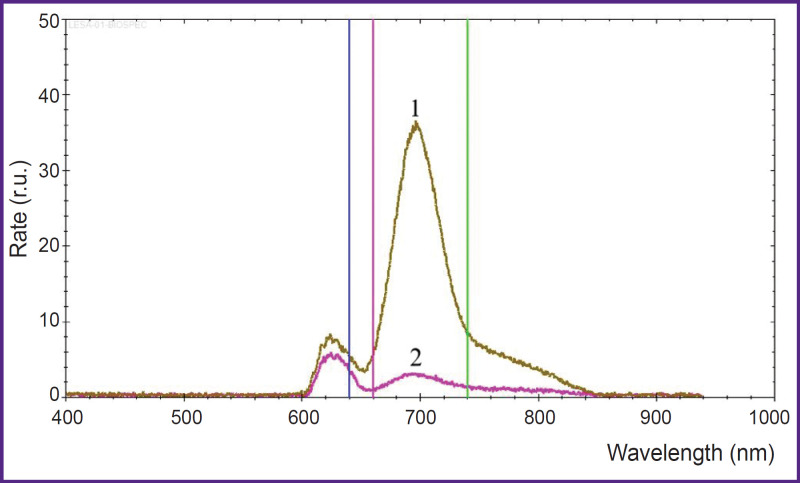 Stereotactic Photodynamic Therapy of Recurrent Malignant Gliomas.