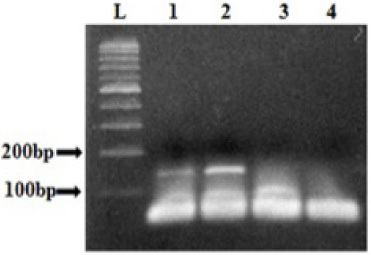 A novel PIK3CA hot-spot mutation in breast cancer patients detected by HRM-COLD-PCR analysis.