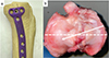 Comparative biomechanical analysis of tibial posterior slope in medial open wedge high tibial osteotomy vs. distal tuberosity osteotomy with and without anterior-posterior screw: a study using porcine tibia.