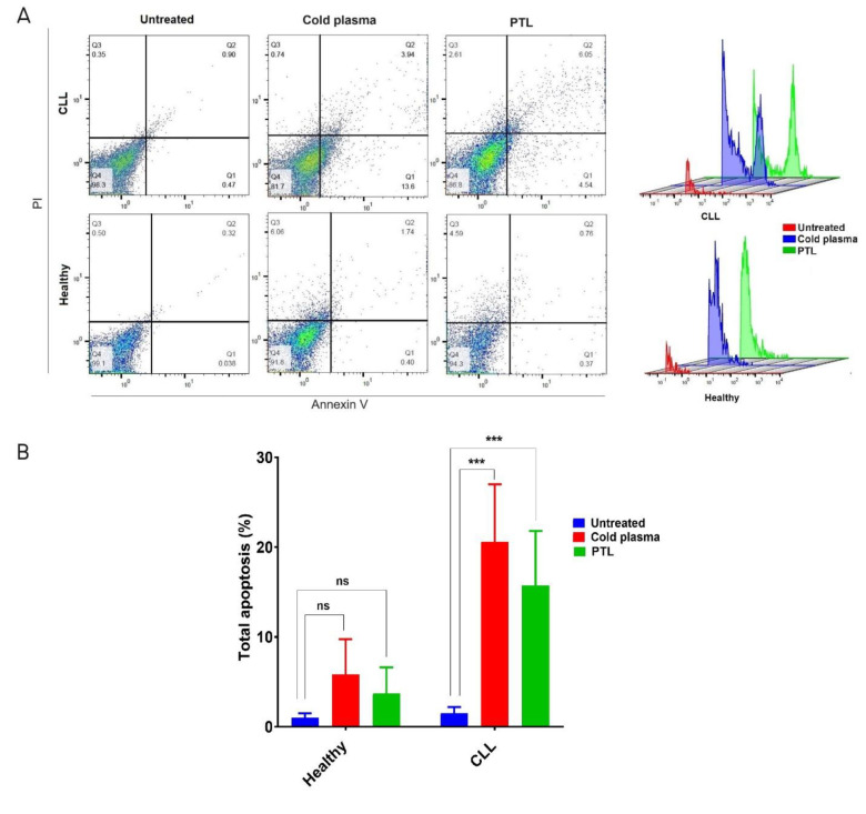 Increased Expression of ITGB 3 in CLL Patient leukemia Cells by Exposure to Cold Physical Plasma and Plasma-treated Medium.