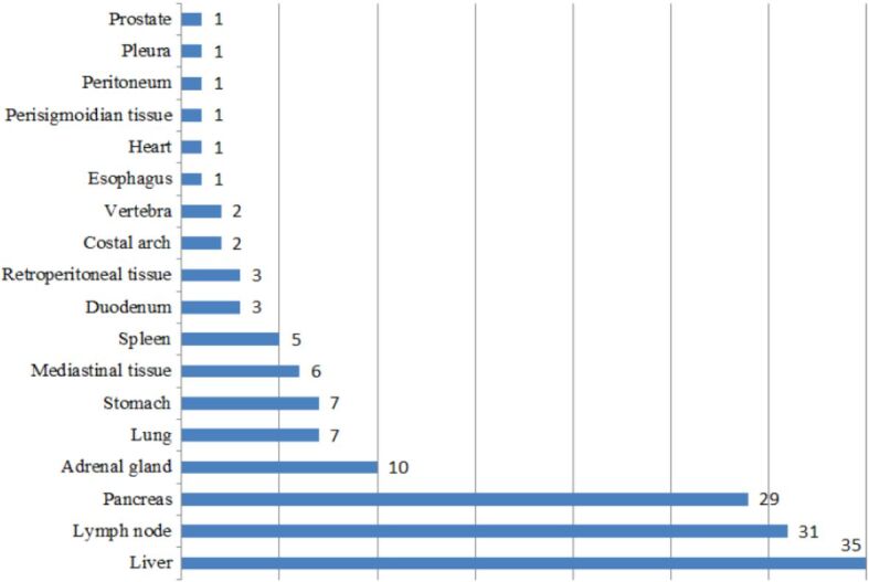 The role of fine-needle aspiration biopsy in the diagnosis of malignant tumors.