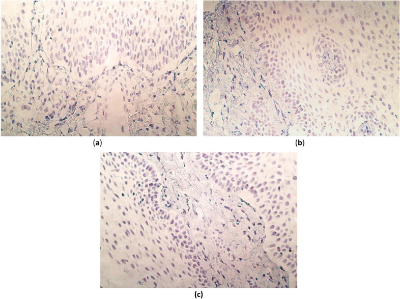 The presence and distribution of various genes in postnatal CLP-affected palatine tissue.