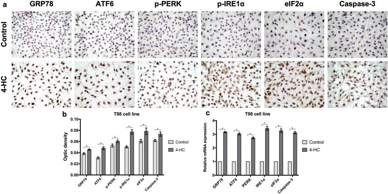 Cyclophosphamide stimulates endoplasmic reticulum stress and induces apoptotic cell death in human glioblastoma cell lines.