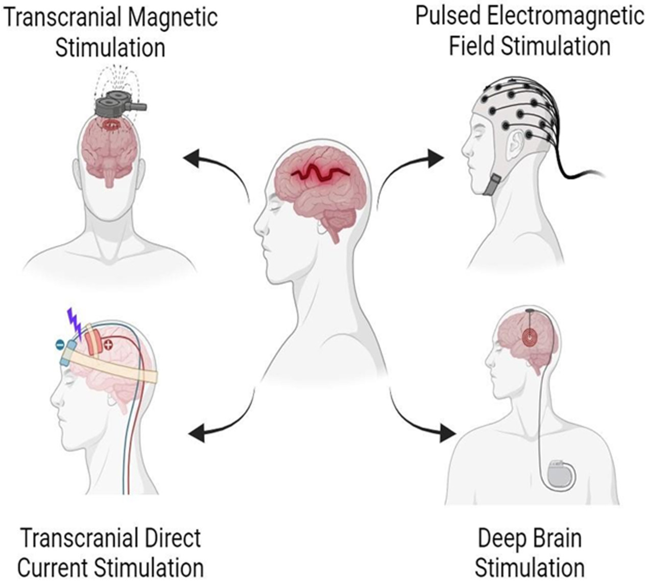 Cellular and Molecular Mechanisms and Innovative Neurostimulation Treatments in the Management of Traumatic Brain Injury.