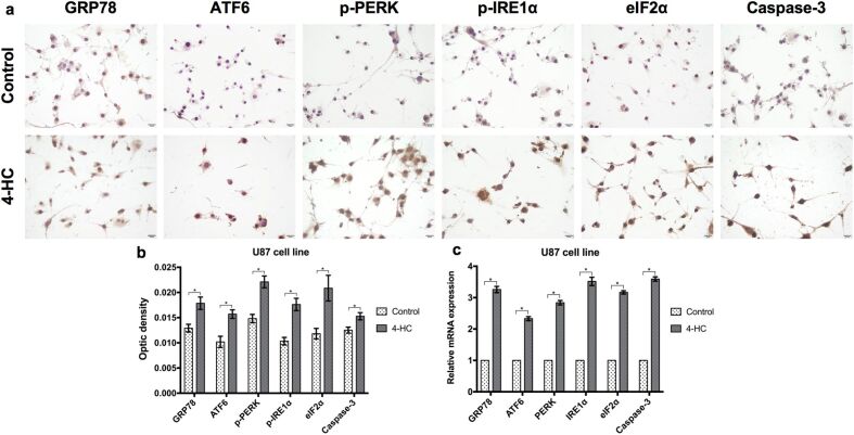 Cyclophosphamide stimulates endoplasmic reticulum stress and induces apoptotic cell death in human glioblastoma cell lines.