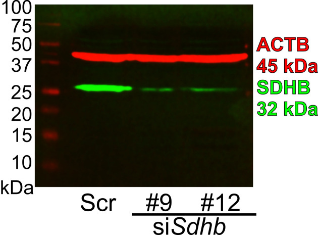 Protocol for gene knockdown using siRNA in organotypic cultures of murine gastric muscle.