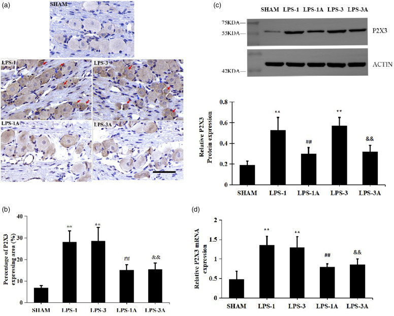 Acute pulpitis promotes purinergic signaling to induce pain in rats via P38MAPK/NF-κB signaling pathway.