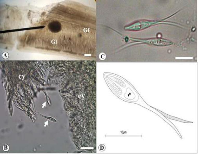 Phylogenetic position inferred on SSU rDNA sequence gene and description of a new parasitic cnidarian (Endocnidozoa: Myxobolidae) infecting <i>Markiana nigripinnis</i> (Teleostei: Stevardiinae) from a small marginal lake floodplain, Brazil.