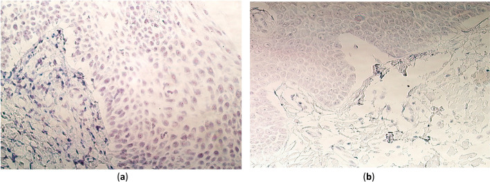 The presence and distribution of various genes in postnatal CLP-affected palatine tissue.