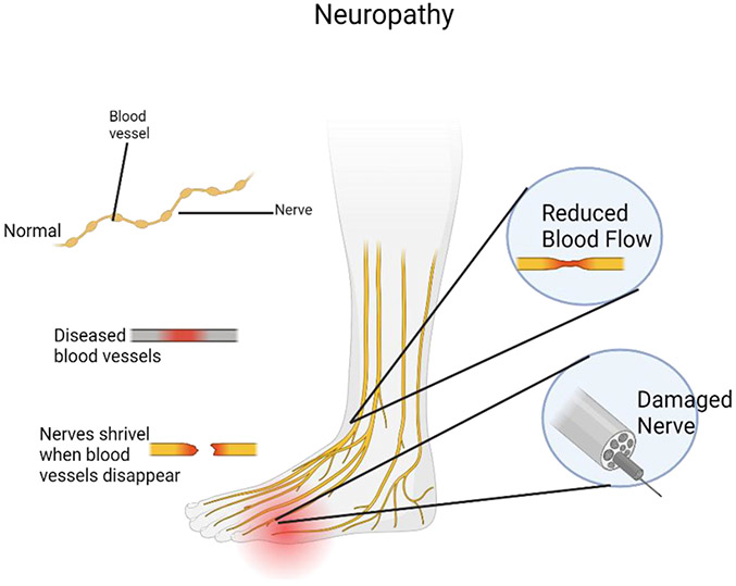 Critical Assessment of the Neurological Complications during High-Risk Anesthesia Procedures.