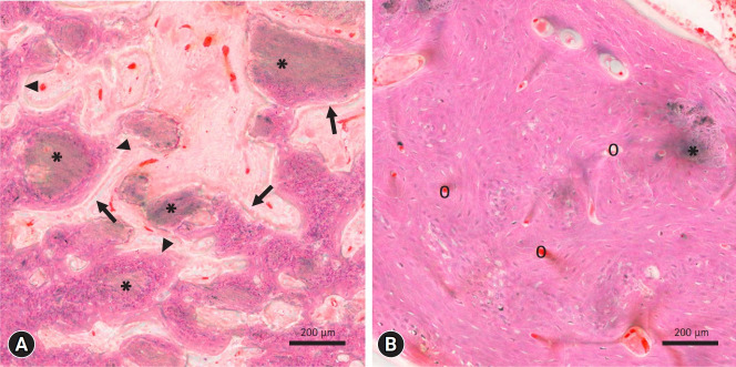 Octacalcium phosphate, a promising bone substitute material: a narrative review.