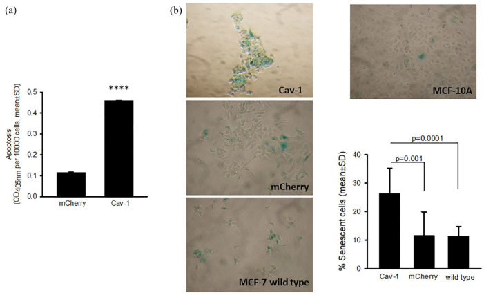 Caveolin-1, a Determinant of the Fate of MCF-7 Breast Cancer Cells.